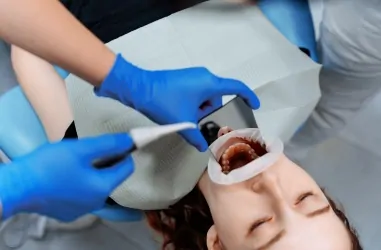 Виды налета и опасность, которую он несет | DENTART Виды налета и опасность, которую он несет