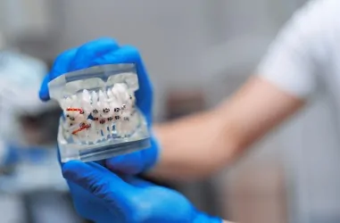 Как работают различные типы дуг и как они помогают в лечении брекетами | DENTART Как работают различные типы дуг и как они помогают в лечении брекетами