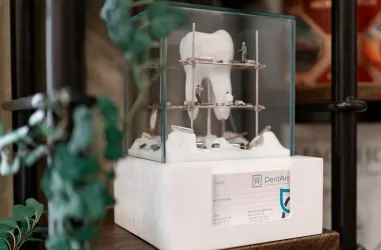 Этапы профессиональной чистки зубов | DENTART Этапы профессиональной чистки зубов
