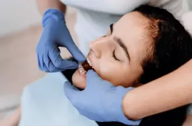 Капы для выравнивания зубов | DENTART Капы для выравнивания зубов