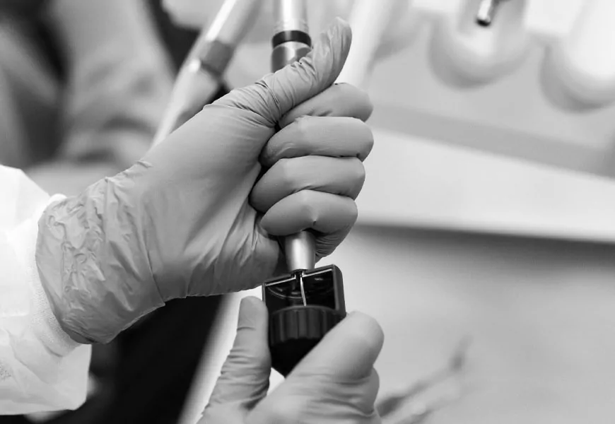 Удаление отложений ультразвуком | DENTART Удаление отложений ультразвуком